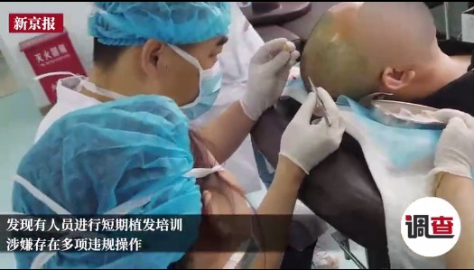 宁波毛发专家表示：植发需要理性，并不是所有人都适合植发手术