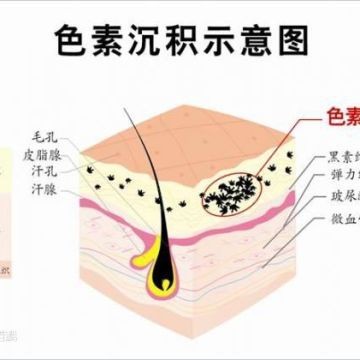 嫩红素有什么副作用吗？选择天然正规产品才靠谱