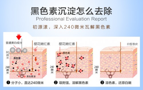 人生"蝶变"只需三个月!去除黑色素沉淀就选初源漾