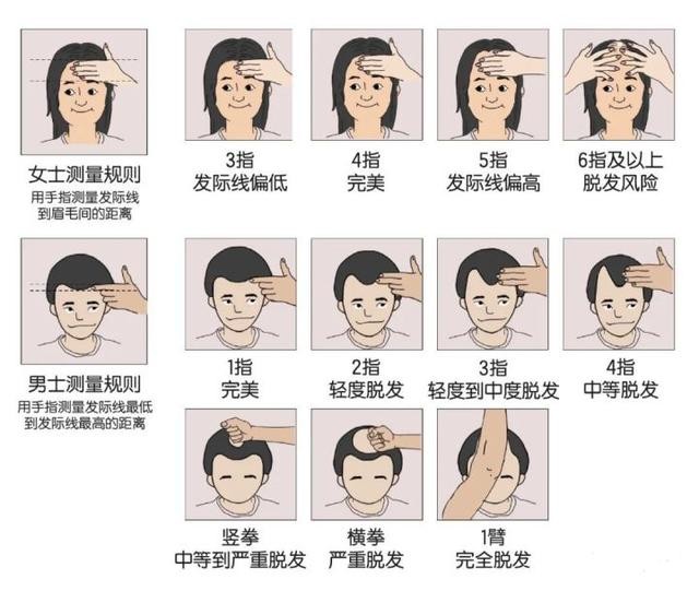 北京熙朵aht艺术发际线植发技术成熟吗有没有后遗症和副作用