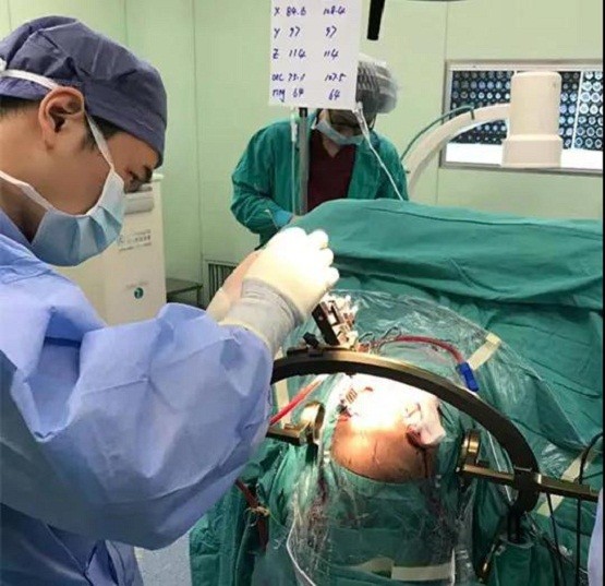 全球首款“脑机接口”的脑起搏器植入手术在我院成功实施