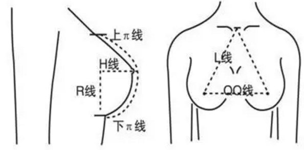 南昌佳美主治医师周娇：关于假体隆胸，你了解多少？