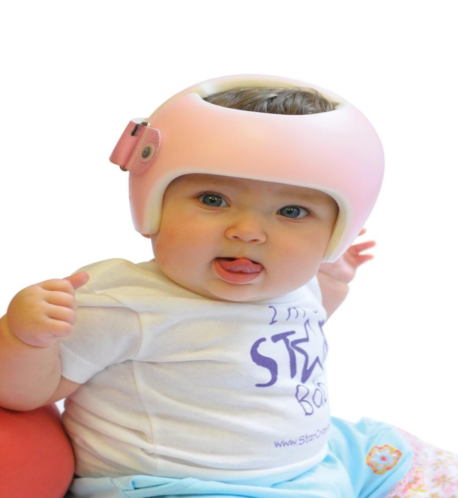 星星矫形头盔，婴儿头颅畸形矫正安全且有效