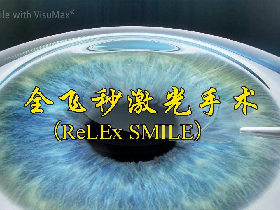 杭州近视手术攻略，全飞秒术后多久能恢复视力？