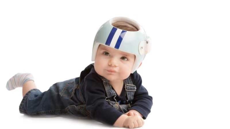 宝宝偏头扁头怎么办？星星矫正头盔——婴儿颅骨矫正的希望