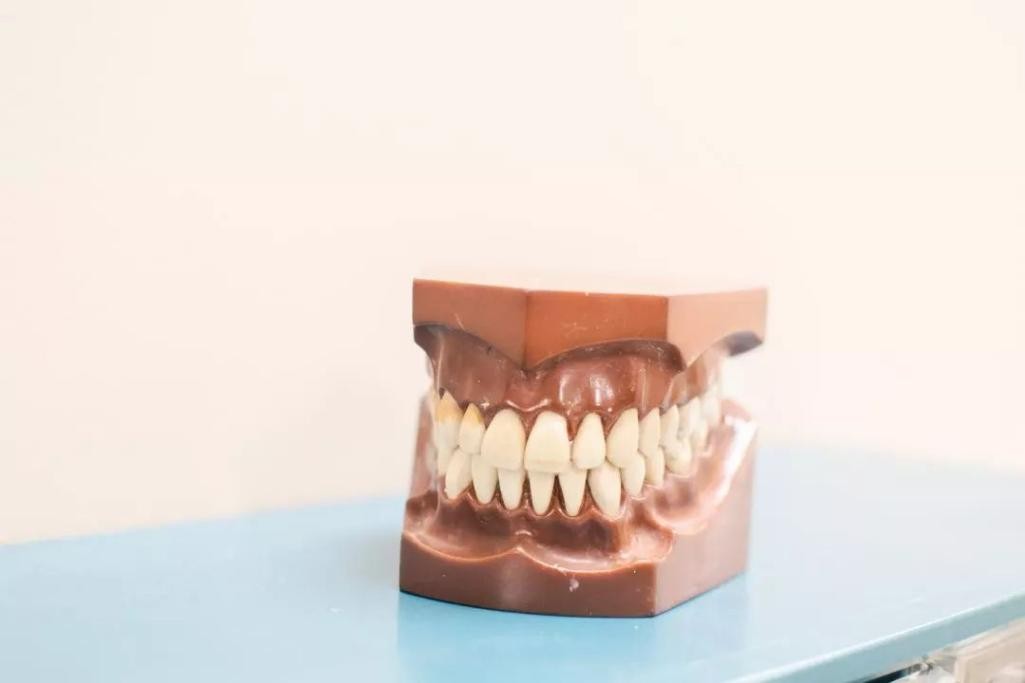 义齿专家刘俊明行业报告—最新消息，新型材料义齿有望取代烤瓷牙！