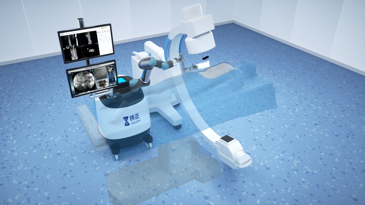 铸正骨科手术机器人以科技力量，造福脊柱疾病患者