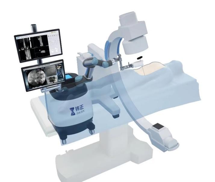 铸正骨科手术机器人协助医疗事业发展，让患者更安心