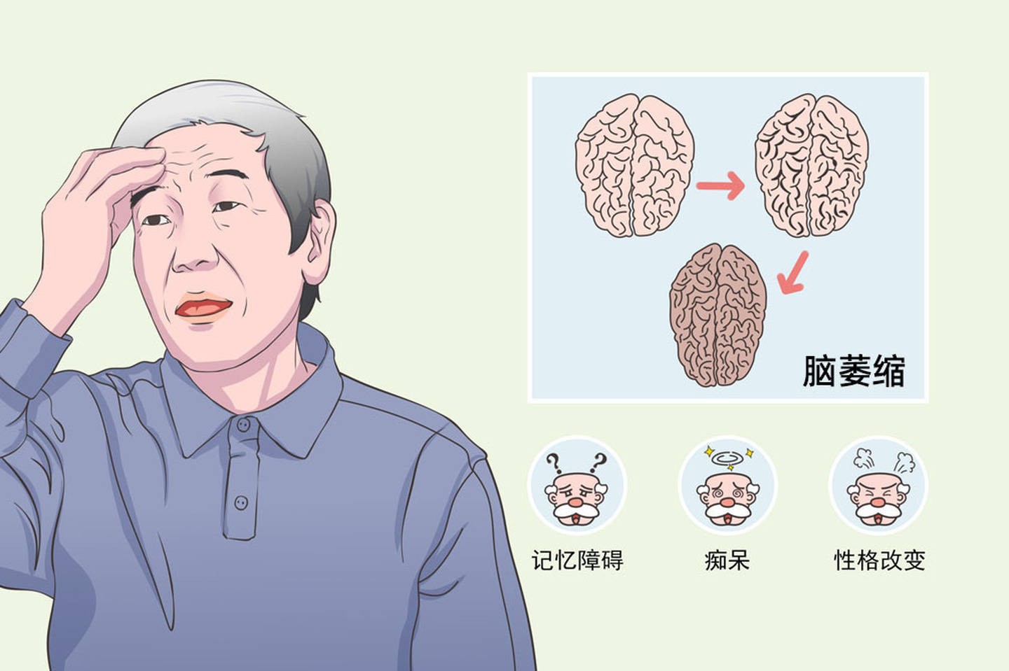 （热门介绍）荣筋行痿汤治疗共济失调