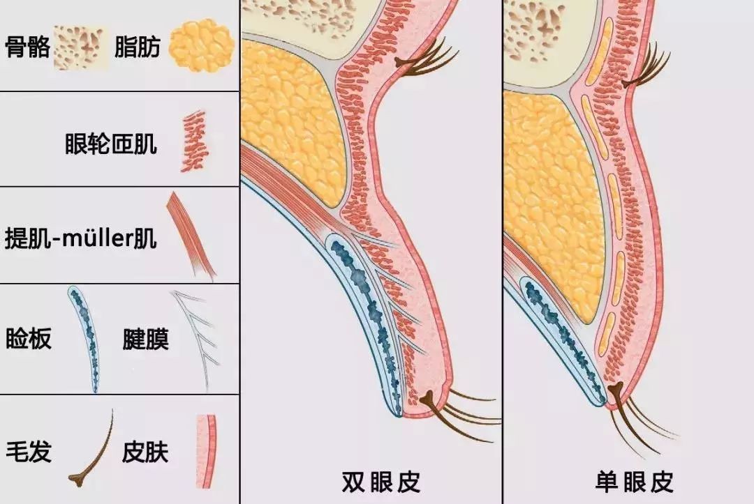 眼睛一单一双，可以只做一边吗？