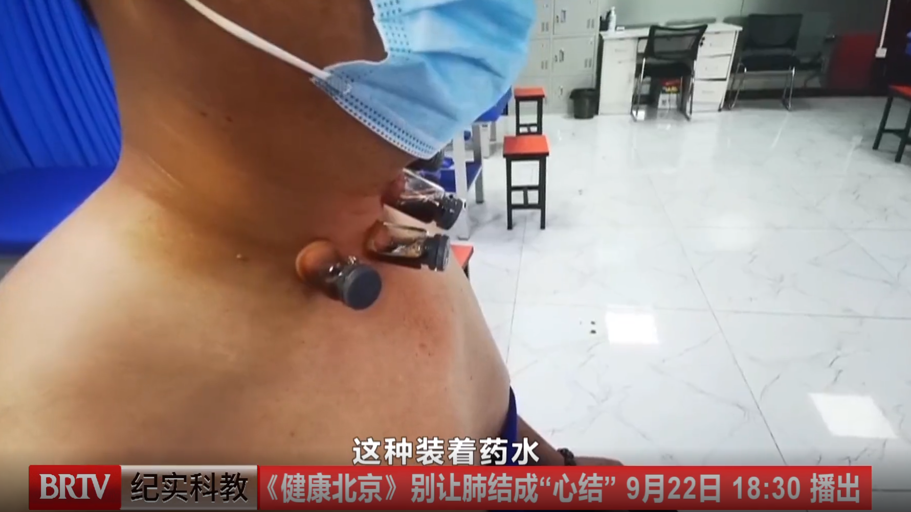 八大处中西医结合医院专家刘培红做客健康北京：别让肺结节成“心结”