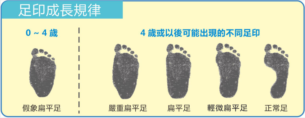 江博士健康鞋：初心如磐守护儿童足部健康