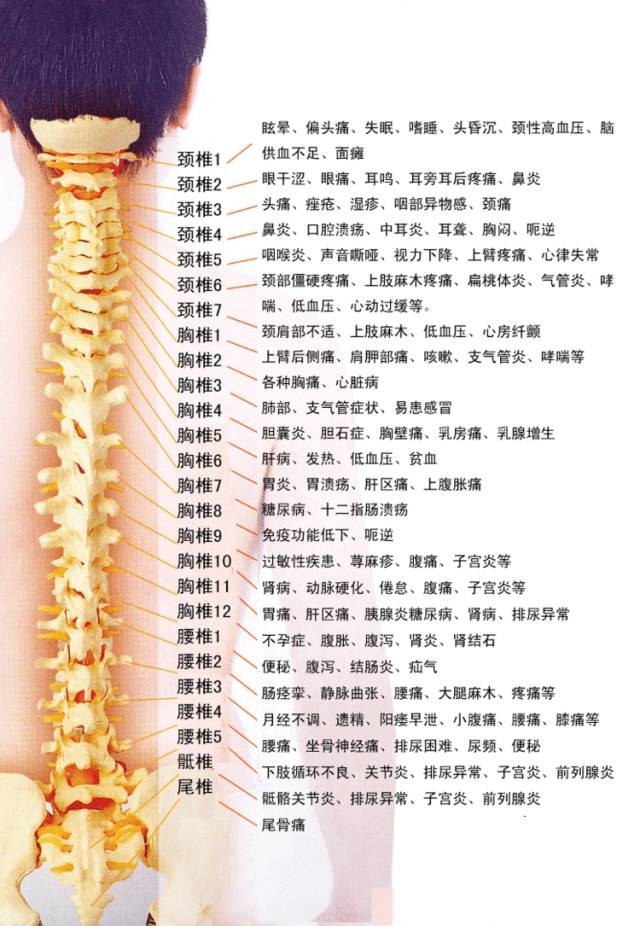 李宇春自爆强直性脊柱炎，这项整脊技术或许有效！