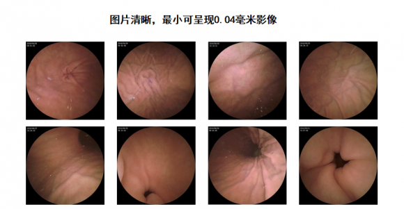 青海东大肛肠医院：什么才是真正的“磁控胶囊胃镜”机器人？