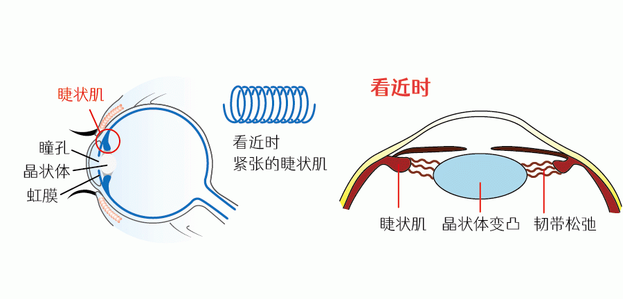 玩電子遊戲,這些事情其實都是在近距離用眼,這種情況下,睫狀肌收縮